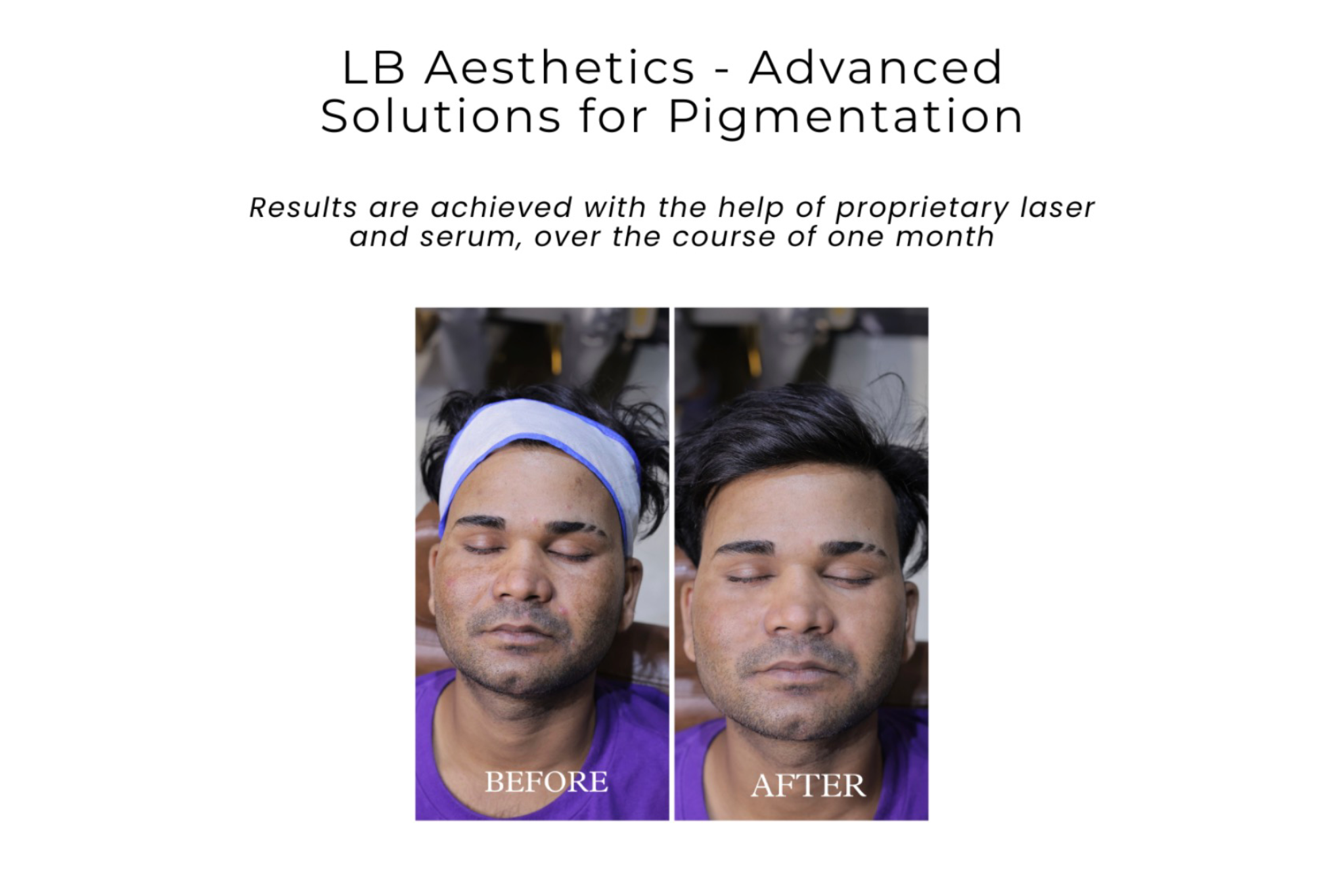 LB Aesthetics Redefines Lip Pigmentation Care in Delhi with Proven Treatments